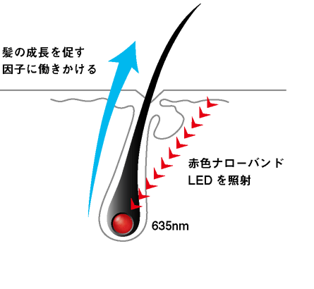 Aderans N-LED FLEX ヘアソリューション アデランス、帽子に装着する「頭皮用 LED 美容機器 N-LED FLEX